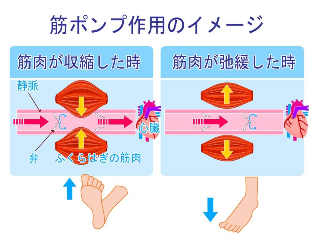 筋ポンプ